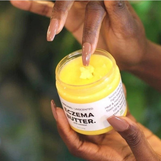 Lizzie’s All-Natural Eczema Butter + Oil